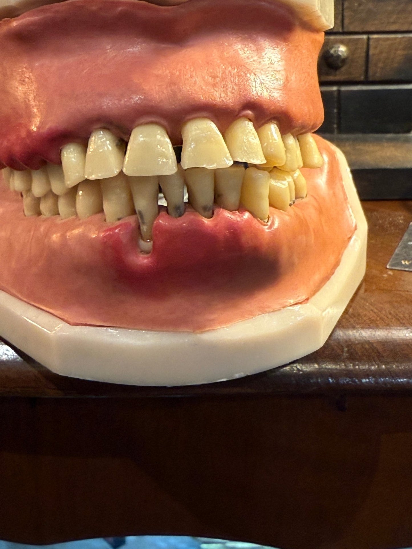 Vintage Dental Model - Loved To Death