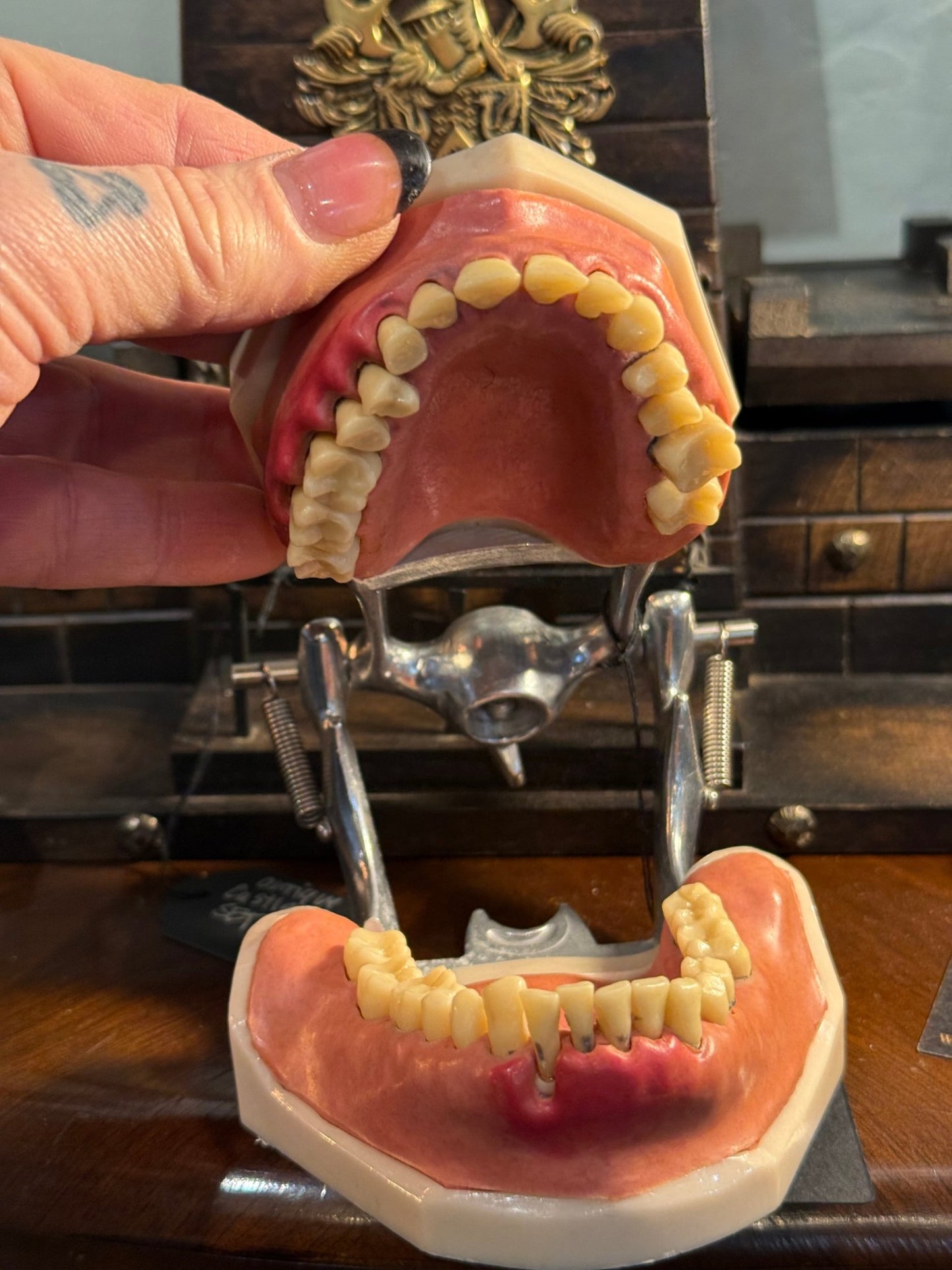 Vintage Dental Model - Loved To Death