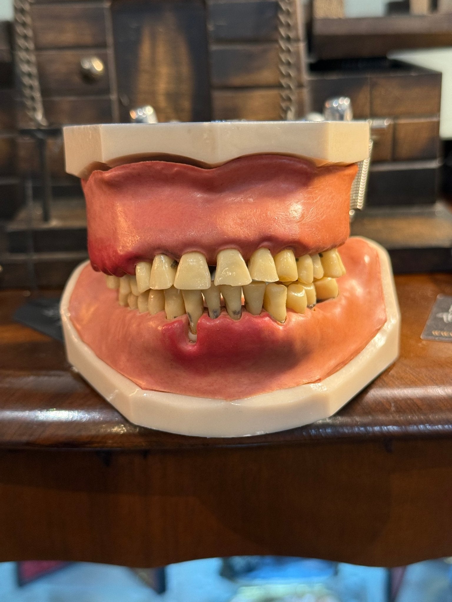 Vintage Dental Model - Loved To Death